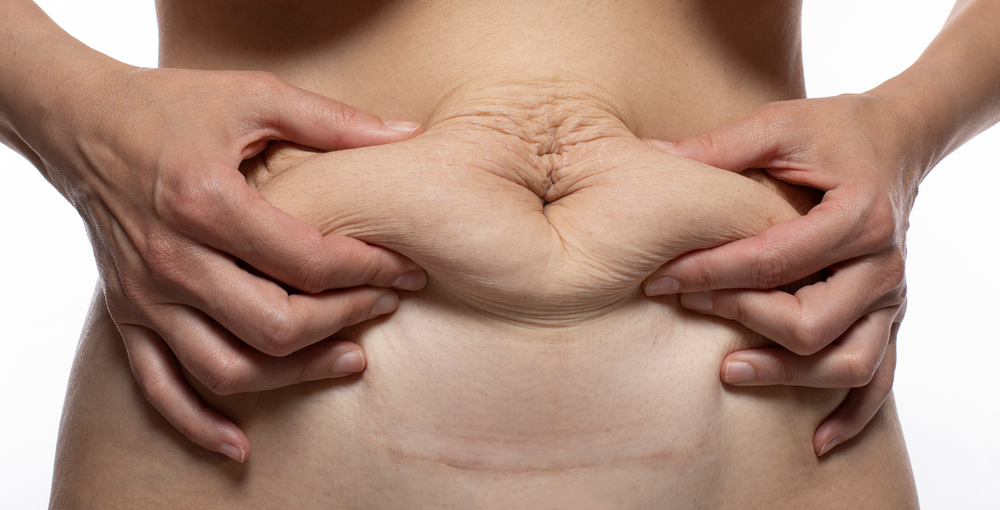 The Role of Exercise in Maximizing Gastric Sleeve Results