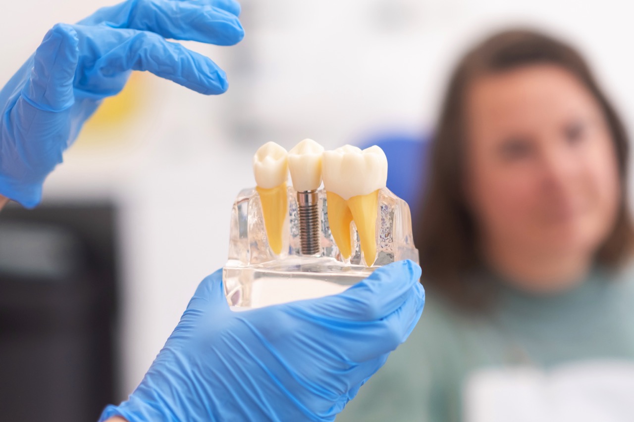 Dental Implants Aftercare: Essential Tips from Turkish Specialists