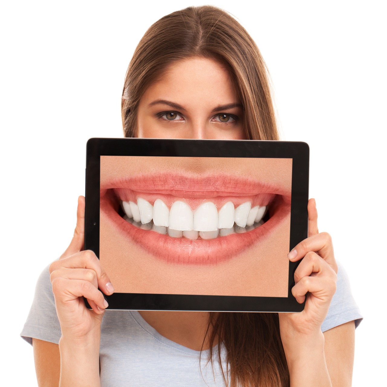 Is Teeth Whitening in Turkey Worth It? Patient Experiences Revealed