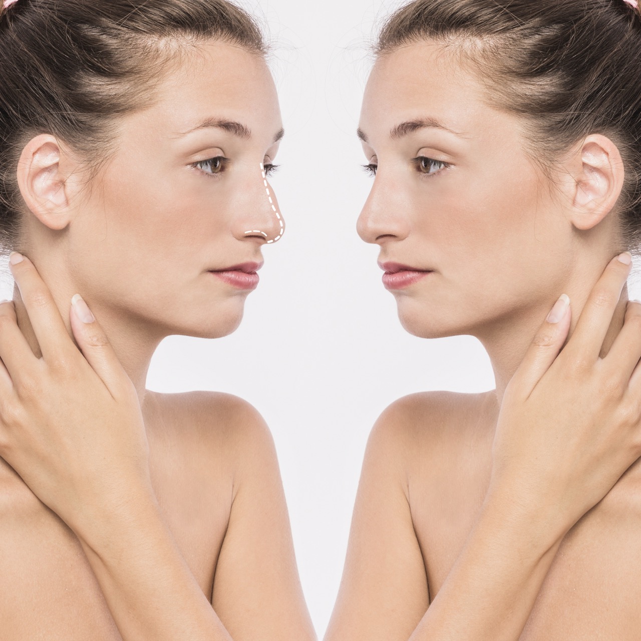 Non-Surgical Nose Job in Turkey: Pros, Cons, and Patient Reviews