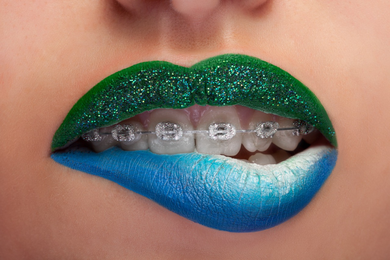 Smile Makeover in Kusadasi: What Makes It So Popular Among UK Tourists?