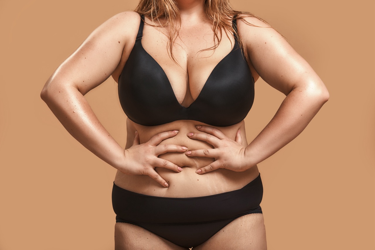 What Causes Gallstones After Gastric Sleeve Surgery?