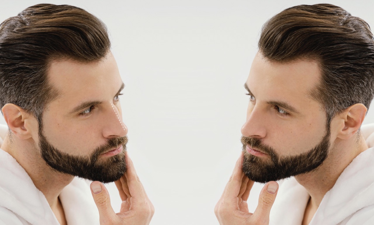 Beard and Mustache Transplants: Exploring New Trends