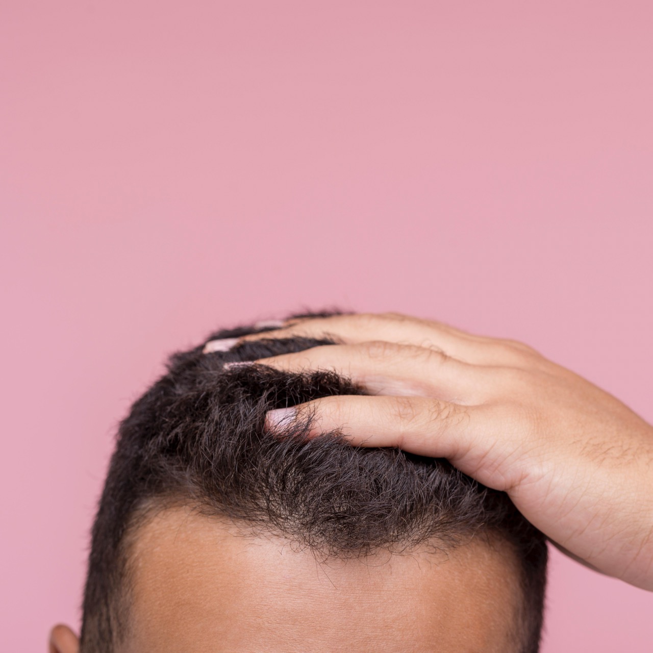 Eyebrow Transplant in Turkey: A Permanent Solution for Sparse Brows