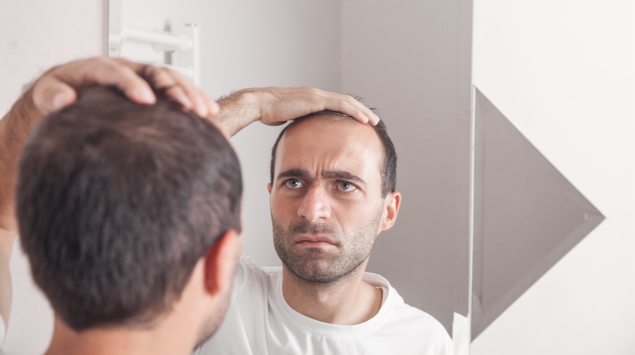 5 Signs You’re a Good Candidate for Hair Transplant Surgery