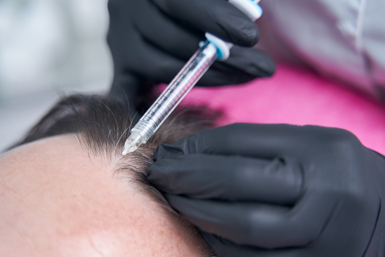 The Role of Biotin and Supplements in Hair Regrowth
